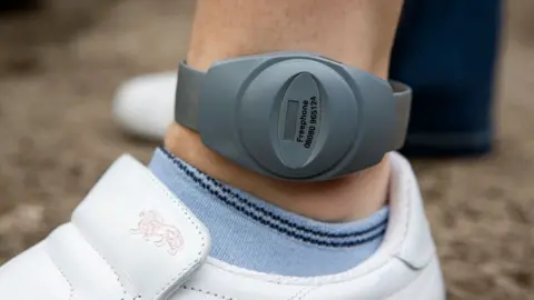 Getty Images A tag on an ankle