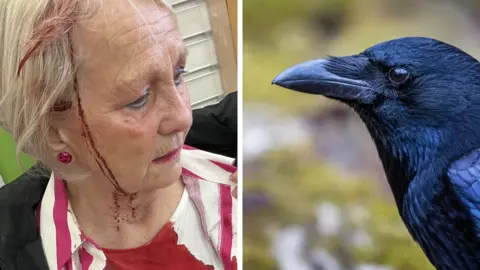 Ian Phillips/Getty Images A woman bleeding from her head and a stock image of a Carrion crow
