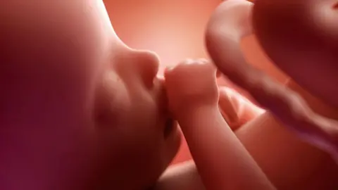 Eraxion foetus