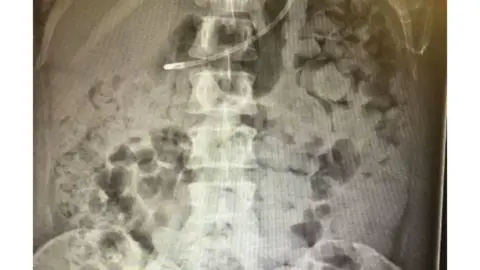 NHS/Kelly Yeoman Faeces