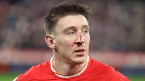 Josh Adams bloodied after a Wales defeat to France