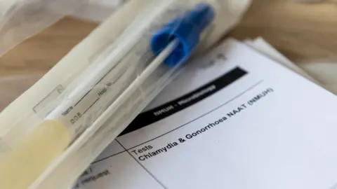 Picture of a generic test for sexually transmitted infections