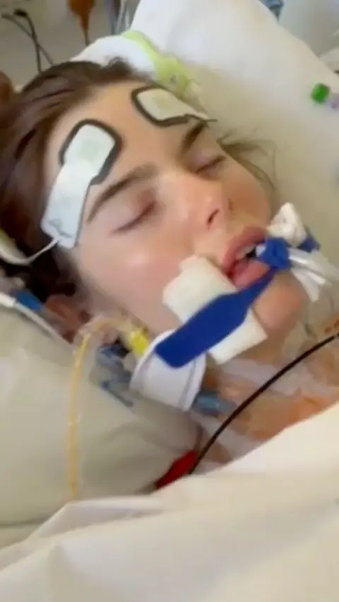 A woman lying in bed attached to tubes.