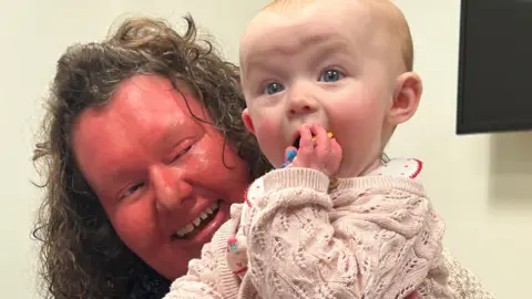 BBC A woman with a red face and curly brown hair is holding a baby who is dressed in a pink jumper