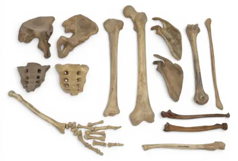 Great Western Auctions A selection of bones, including those of a hand, laid out.