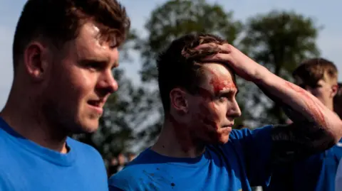 Getty Images Two bottle kickers, in blue t-shirts. One is holding his head and has blood on his face