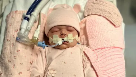 Family handout Pippa Gillibrand has breathing tubes in her nose attached to an oxygen line. She wears a pink hat and romper suit. She lies unconscious on pink bedding. 