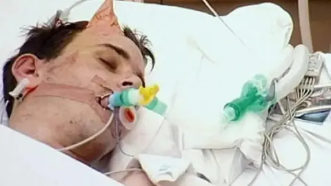 Family photo A man is seen lying in a hospital bed with tubes going into his mouth. He has brown hair and his eyes are closed.