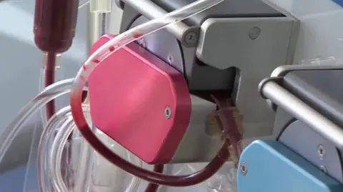 A pink, blue and silver dialysis machine with plastic tubes of blood flowing to suspended larger container.