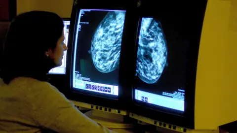 A scan of breasts on two monitors in a cancer screening.