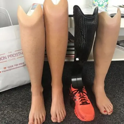 Victoria Milligan Lost legs