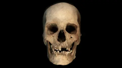 A stark, white human skull is depicted against a black Backround