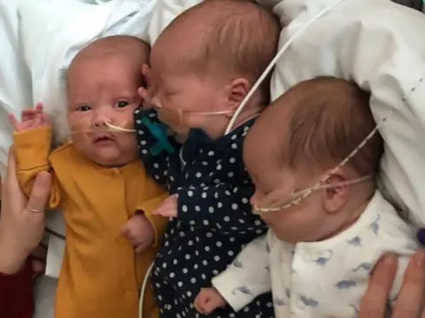 Worcestershire Acute Hospitals NHS Trust Triplets