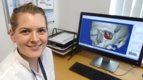 Abertawe Bro Morgannwg University Health Board Heather Goodrum digitally recreating a eye socket