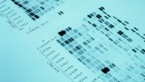 Science Photo Library DNA fingerprint