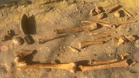 Nick Routledge A collection of human bones in dry soil, including what looks like leg bones. The bones are yellowy brown and partially covered with soil. 