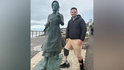 Ryan Eddowes Ryan was born with clubfoot and has a lower-knee amputation on his right leg. He stands next to the Mary Anning statue in Lyme Regis (Dorset) where his grandparents would take him as a youngster, fostering a love of animals. He wears a black puffy jacket, has short black hair and wears beige shorts.