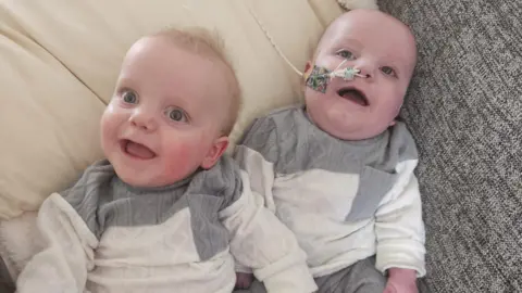 A pair of twins wearing grey and white cable knit jumpers smile as they lie next to one another on a grey sofa. One of them has a feeding tube attached to his nose.