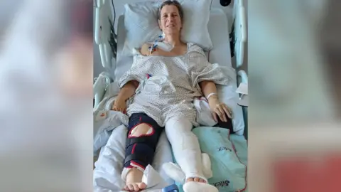 Janet Crook-Moore in a hospital bed with casts around her legs.