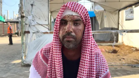 Ahmed al-Dalou, photographed in Gaza. He was a man in his 30s or 40s, with a short black beard. His head was bandaged, and his face showed signs of recent severe burns to his forehead and nose.