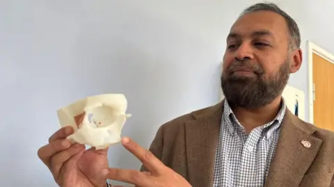 PA Media A man is holding a small, white model of a human skull, specifically the eye socket. He is holding the model in one hand while using the other hand to point at a specific area of it. He is dressed in a brown blazer worn over a patterned shirt.