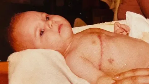 Kerry Fear Kerry Fear as a baby with clear scars across her chest