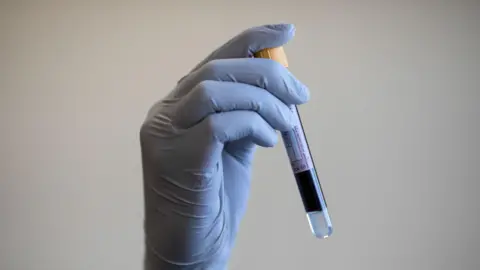 A blue-gloved hand holding a test tube containing a blood sample.