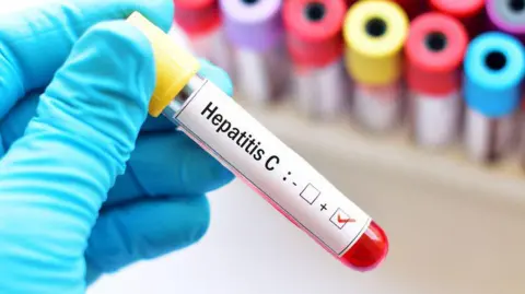 A test tube of blood has a sticker on it saying Hepatitis C held by a hand wearing a blue glove. Test tubes with colourful lids can be seen in the background, blurred.
