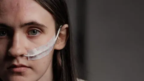 Gavin Hopkins Young woman with dark hair and a nasogastric tube 