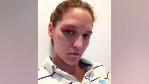 Alexis Quinn Alexis Quinn soon after she was detained under mental health legislation