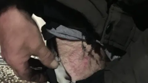 The Paper Cup Project Injury caused by firework