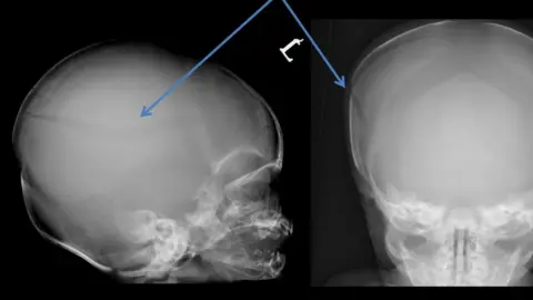 Hampshire Constabulary X-rays
