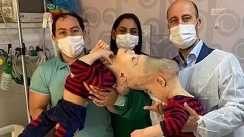 PA Media Bernardo and Arthur Lima with parents and surgeon
