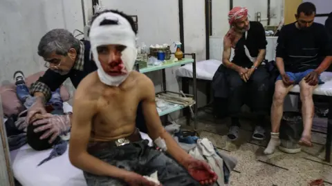 EPA Injured people receive care at a field hospital in the Eastern Ghouta, Syria (27 November 2017)