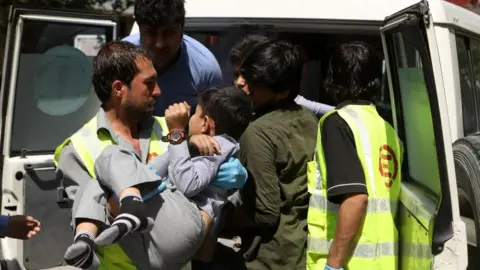 EPA Child injured in Kabul attack. 1 July 2019