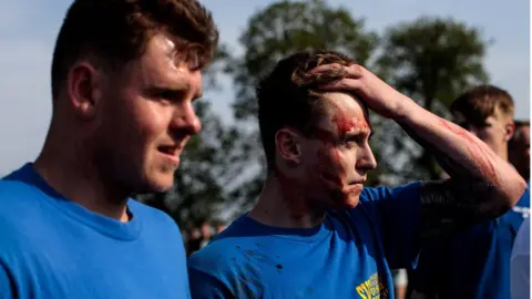 Getty Images Hallaton bottle kicking