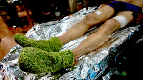 BBC / Darren Conway The wounded soldier's feet are kept warm in hand-knitted woolen socks