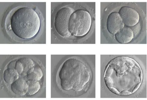 Kathy Niakan Human embryo development