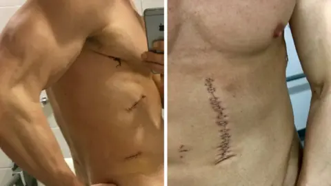 West Midlands Police hand out Will Flint's scars