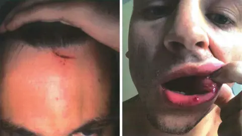 Avon and Somerset Police Injuries to Ryan Hale