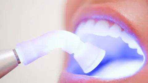 Getty Images Teeth whitening