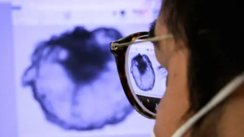 FABRICE COFFRINI/AFP A researcher poses with a monitor showing a tumor at an animal testing laboratory of the University of Geneva on January 18, 2022.