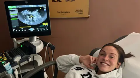 Vicky Pattison Vicky having a scan