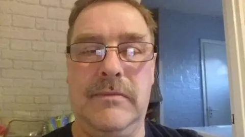 University Hospitals of North Midlands Mark Elliott