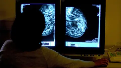 PA Media Mammogram