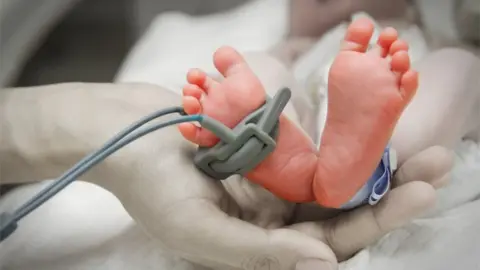 Getty Images Premature baby