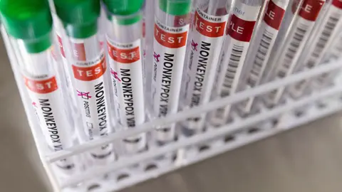 Reuters Monkeypox tests