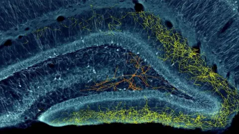 Dr. Gyorgy Buzsaki, NYU Neuroscience Institute brain