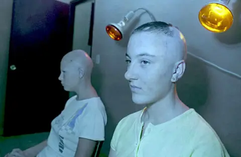 Getty Images Two teenage victims of the 1986 Chernobyl nuclear disaster receive infrared radiation treatment in Cuba