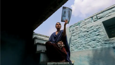 Ashish V Urmila Yadav with an X-ray of her lungs